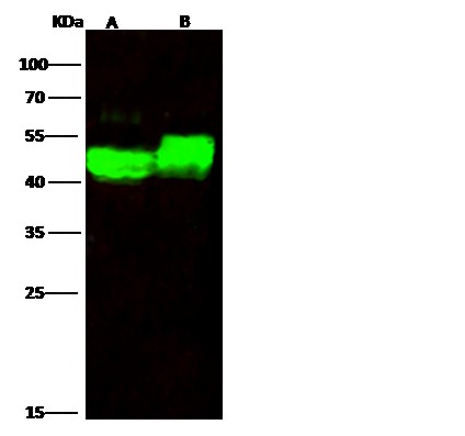 Recombinant alpha-Galactosidase A/GLA Monoclonal Antibody (AN300412P)