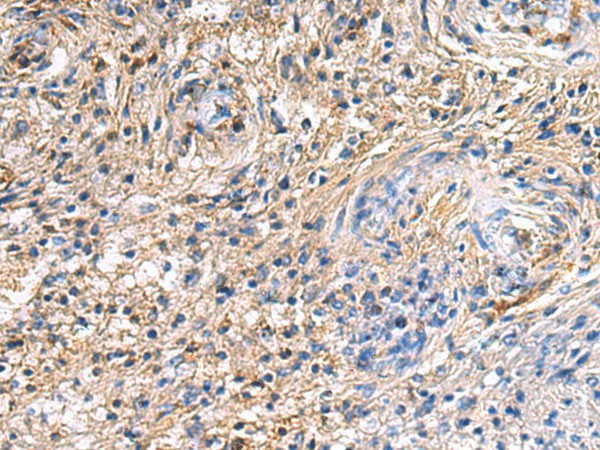SAV1 Polyclonal Antibody (E-AB-19264)