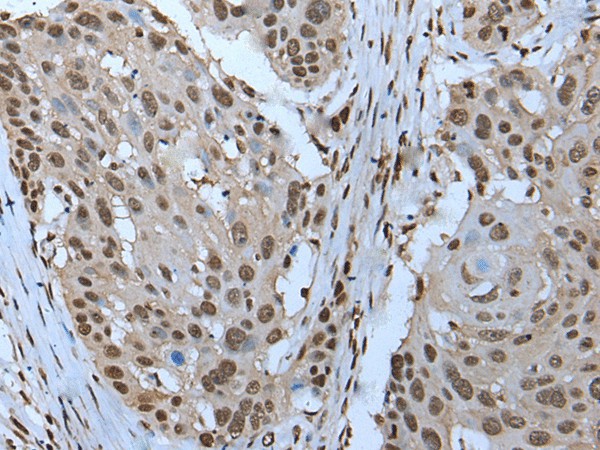 ZNHIT3 Polyclonal Antibody (E-AB-53535)