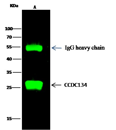 Recombinant CCDC134 Monoclonal Antibody (AN300266P)