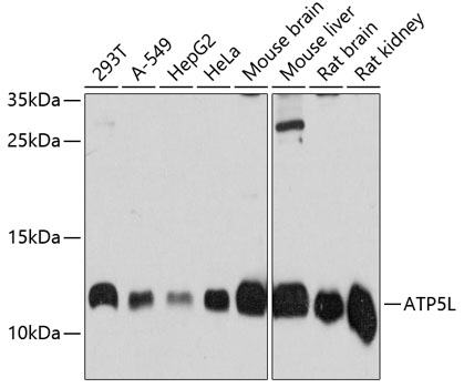 ATP5L Polyclonal Antibody (E-AB-63942)