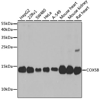 COX5B Polyclonal Antibody (E-AB-62049)