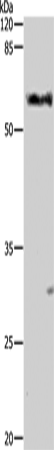 ALDH1A1/2/3 Polyclonal Antibody (E-AB-13801)