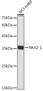 NKX2-1 Polyclonal Antibody (E-AB-92513)