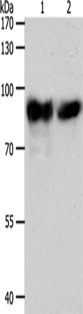 ACO2 Polyclonal Antibody (E-AB-16130)