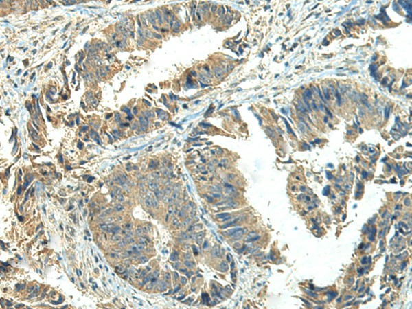 NPVF Polyclonal Antibody (E-AB-19861)