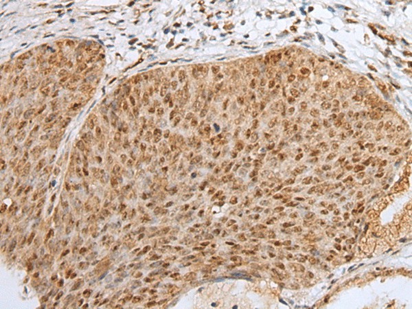 ZNF354A Polyclonal Antibody (E-AB-18464)