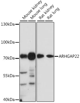 ARHGAP22 Polyclonal Antibody (E-AB-91580)