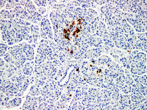 Somatostatin Monoclonal Antibody (ELAB6653-M)