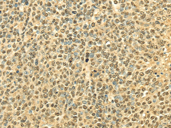 RPA2 Polyclonal Antibody (E-AB-17007)