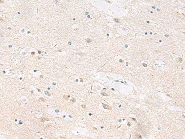 ANKS6 Polyclonal Antibody (E-AB-53106)