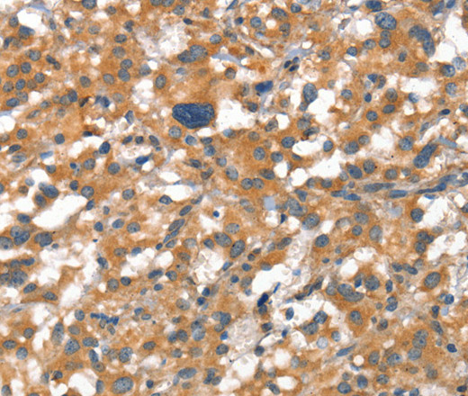 VE-Cadherin Polyclonal Antibody (E-AB-12772)