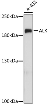 ALK Polyclonal Antibody (E-AB-65707)