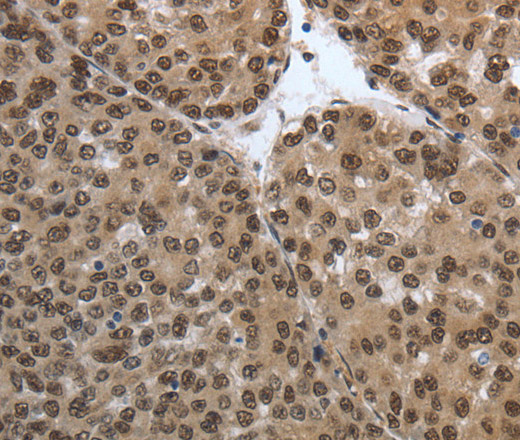 SMAD7 Polyclonal Antibody (E-AB-15853)