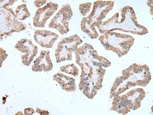 ABCD1 Polyclonal Antibody (E-AB-19528)