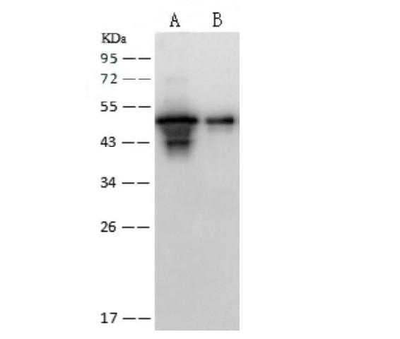 Anti-SARS-CoV Nucleoprotein / NP Polyclonal Antibody (E-AB-V1340)
