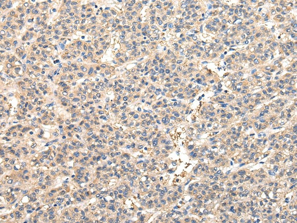 VPS45 Polyclonal Antibody (E-AB-17268)