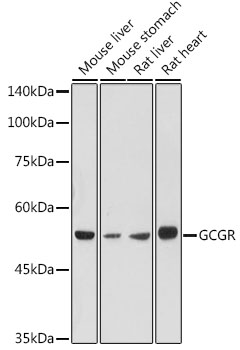 GCGR Polyclonal Antibody (E-AB-90226)