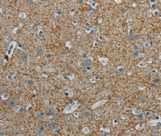 PGLYRP1 Polyclonal Antibody (E-AB-16706)
