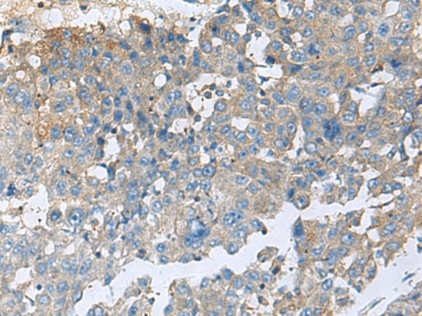 CEMIP Polyclonal Antibody (E-AB-52102)