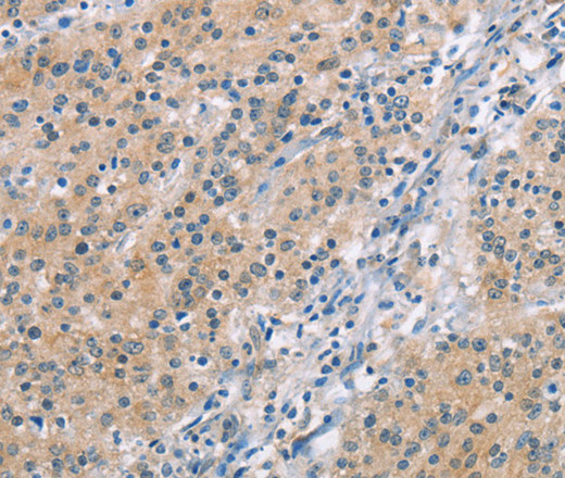 MCL1 Polyclonal Antibody (E-AB-16255)