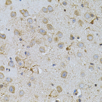 NAT8 Polyclonal Antibody (E-AB-62294)