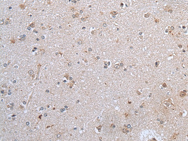 CLDN12 Polyclonal Antibody (E-AB-53357)