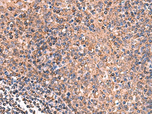 GALK2 Polyclonal Antibody (E-AB-52963)