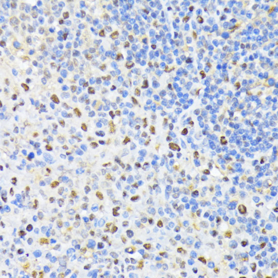 PCNA Polyclonal Antibody (E-AB-64562)
