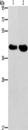 STK17A Polyclonal Antibody (E-AB-13203)