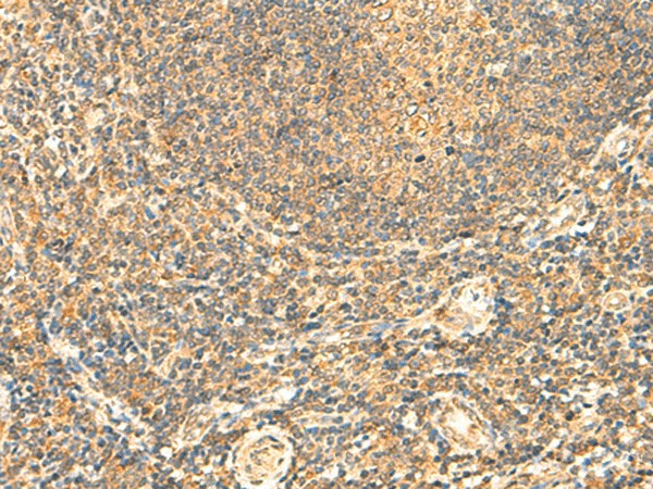 LYZL1 Polyclonal Antibody (E-AB-18931)