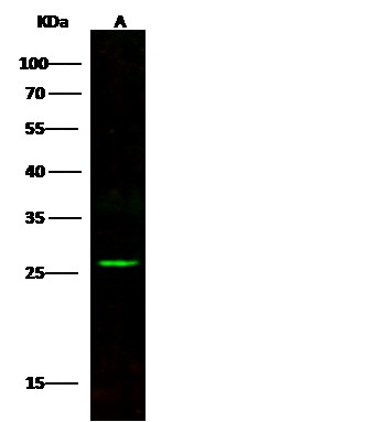 Recombinant Bcl-2 Monoclonal Antibody (AN300031P)