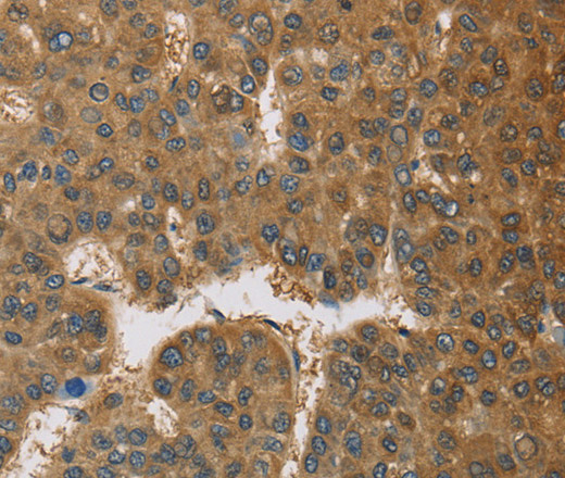 TNFRSF10D Polyclonal Antibody (E-AB-11141)