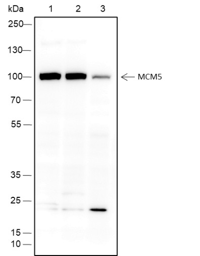 Recombinant MCM5 Monoclonal Antibody (AN301598L)