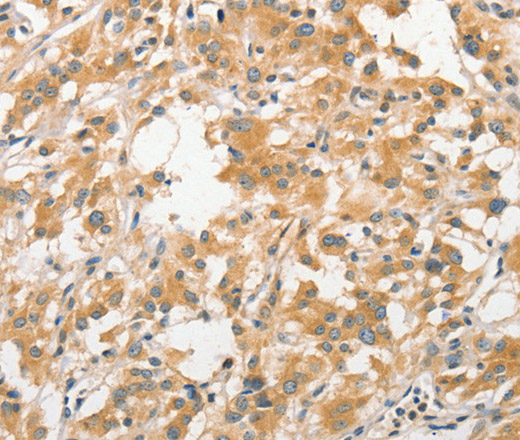 APC5 Polyclonal Antibody (E-AB-10810)