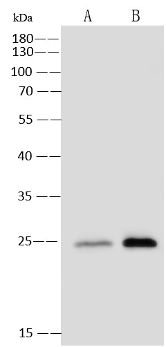 G-CSF Monoclonal Antibody (AN200034P)