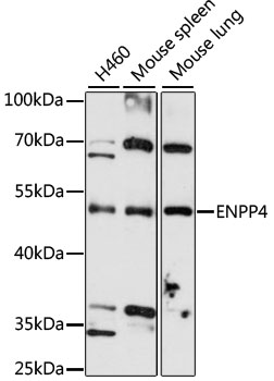 ENPP4 Polyclonal Antibody (E-AB-92598)