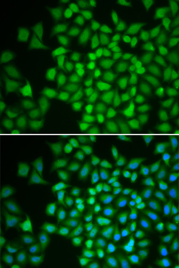COPS5 Polyclonal Antibody (E-AB-64612)