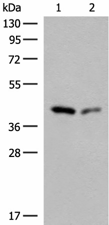 GIPC1 Polyclonal Antibody (E-AB-18000)