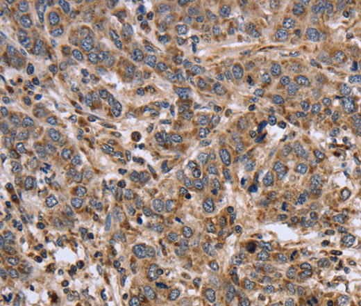 EPOR Polyclonal Antibody (E-AB-15623)