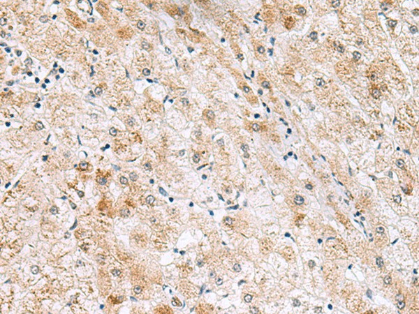 GPC2 Polyclonal Antibody (E-AB-19457)