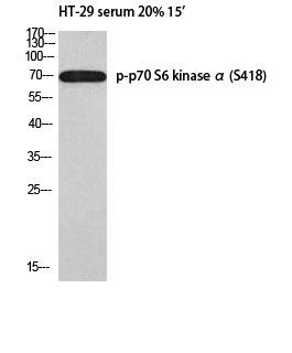Phospho-p70 S6 kinase alpha (Ser418) Polyclonal Antibody (E-AB-21476)