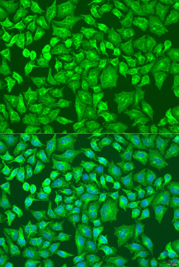 DVL2 Polyclonal Antibody (E-AB-66334)
