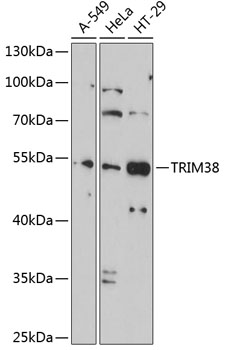 TRIM38 Polyclonal Antibody (E-AB-92477)