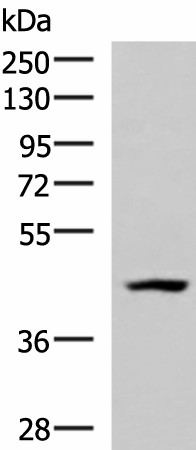 MAGEC2 Polyclonal Antibody (E-AB-52920)