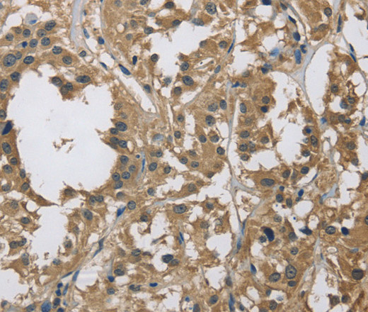 DSG2 Polyclonal Antibody (E-AB-14949)