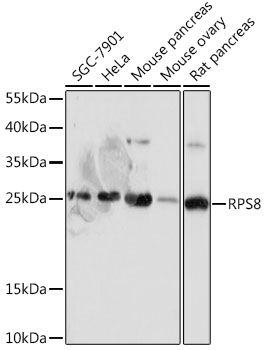 RPS8 Polyclonal Antibody (E-AB-92028)