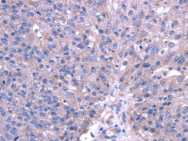 TRIM49 Polyclonal Antibody (E-AB-17093)