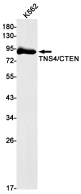 Recombinant Tensin 4 Monoclonal Antibody (E-AB-81611)