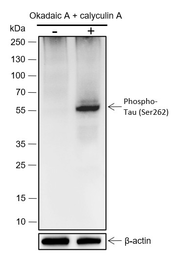 Recombinant Phospho-Tau (S262) Monoclonal Antibody (AN301700L)